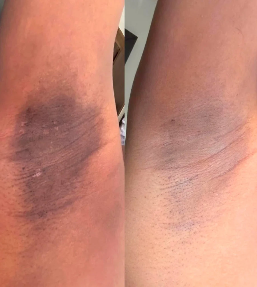 ADEUS Crème Banana Correctrice Anti-Taches